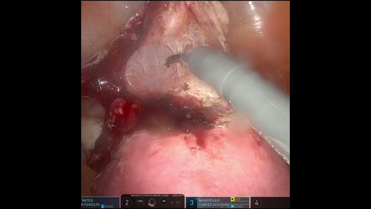 Ángel Millán Juárez-102