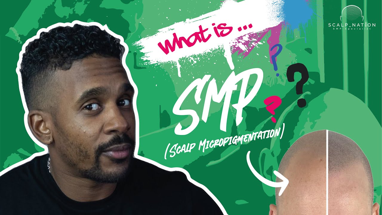 What is scalp micropigmentation?