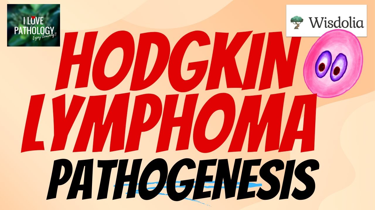 HODGKIN LYMPHOMA  | PATHOGENESIS | Reed-Sternberg Cell