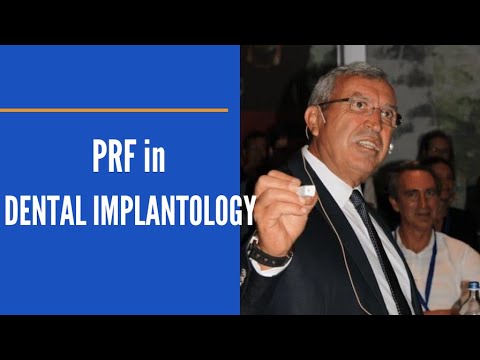 PRF application in Dental Implantology | Dental Iceberg