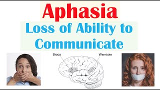 Aphasia | Types (Broca’s, Wernicke’s, Global), Causes, Signs &amp; Symptoms, Diagnosis, Treatment