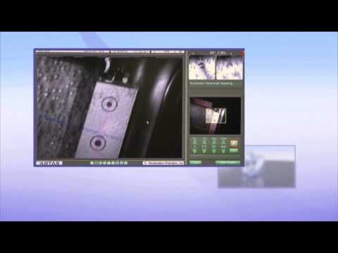 Dr. Bernard Arocha Uses Robotics to Transform Hair Restoration