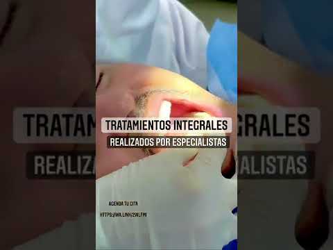 video BbXP0JEtaN8