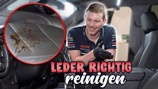 Mit DIESER Methode sehen Ledersitze wieder aus wie neu!