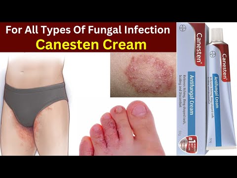 Canesten clotrimazole antifungal cream, 1% w/w