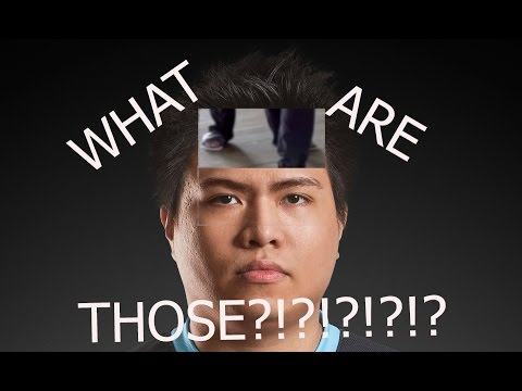 Xmithie   WHAT ARE THOSE!