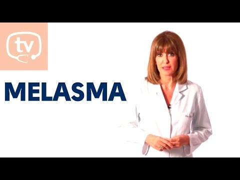 ¿Qué es y cómo tratar el melasma?