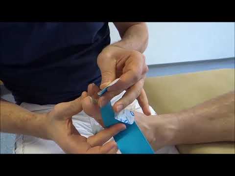 Hallux Valgus Kinesio Tape