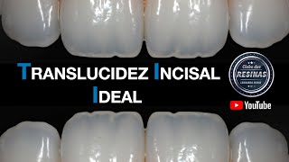 Translucidez incisal ideal