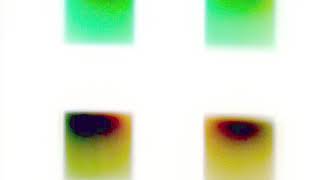 Simple Minds  - Magic (Johnson Somerset remix)