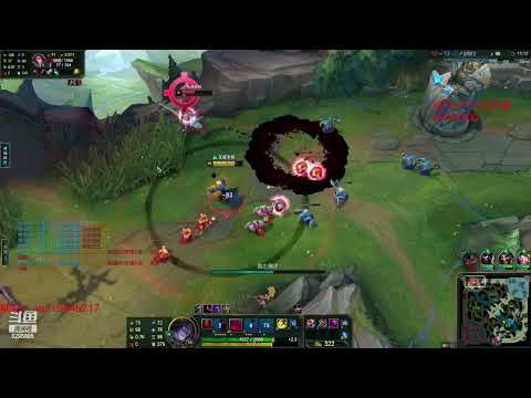 ZuoShou Vladimir vs Zoe ✅ Best Cn Vladimir Guide