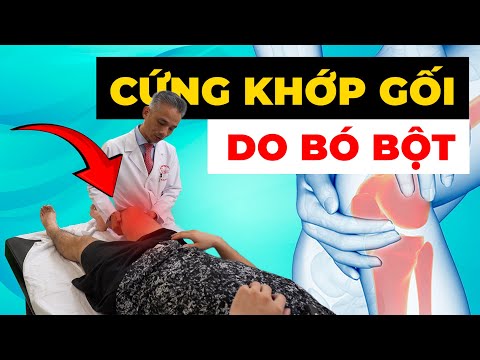 KHỦNG HOẢNG: Khớp Gối Cứng Như Đá Sau Bó Bột - Bác Sĩ Hướng Dẫn Phục Hồi