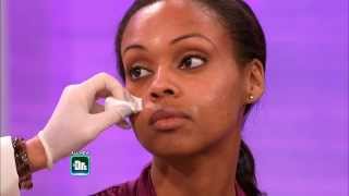 Unexpected Fix for Oily Skin -- The Doctors