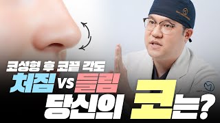 코성형 후, 코끝! 떨어져도 올라가도 문제? 성형외과전문의 박용식 원장