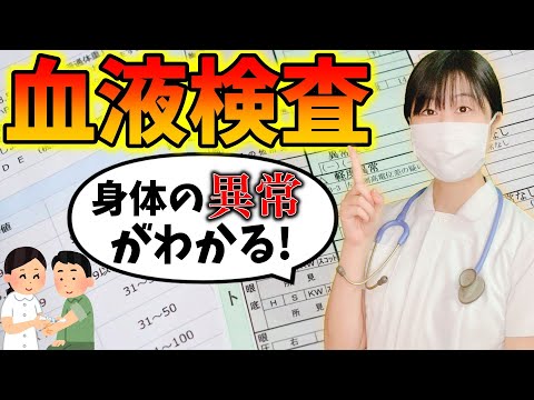 アクティブな読み取り値 - 定義