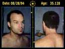 Man’s 17 Years Of Hair Loss In One Time-Lapse Video
