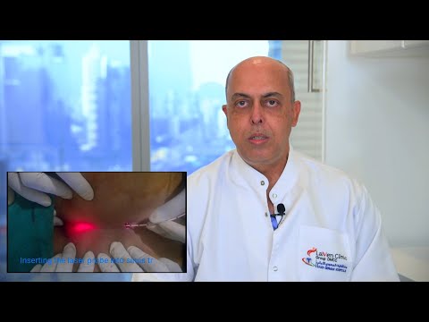 Pilonidal Cyst The Minimally Invasive Laser Solution - Dr. Salil - Laven Clinic