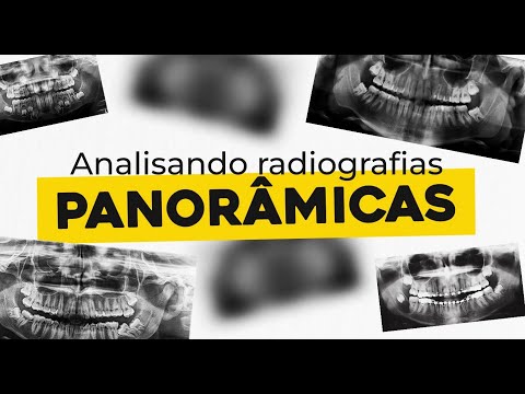 Analyzing panoramic radiographs | RADIOLOGY
