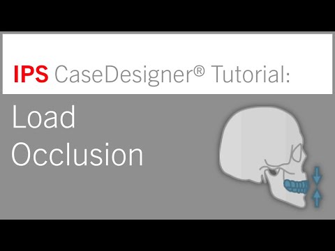 Workflow 3 – Load Occlusion | IPS CaseDesigner® Tutorial