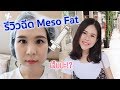 เมโส แฟต