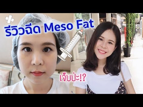 เมโส แฟต