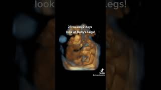 Download lagu 23 weeks 2 days pregnant- 4D Ultrasound video mp3 Download lagu 23 weeks 2 days pregnant- 4D Ultrasound video mp3