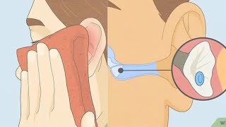 How to Drain Ear Fluid: Natural Techniques & When to See a Doctor