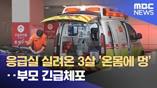 응급실 실려온 3살 '온몸에 멍'‥부모 긴급체포 (2026.04.11/뉴스25/MBC)