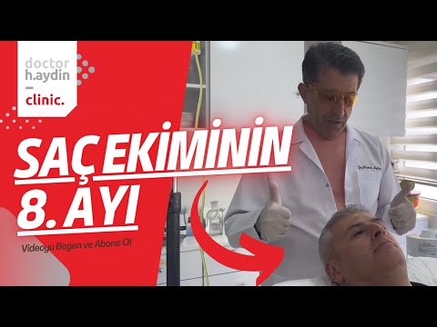 Saç Ekiminin 8. Ayında Bakın Hastamız Ne Diyor? - Dr. Hamid AYDIN