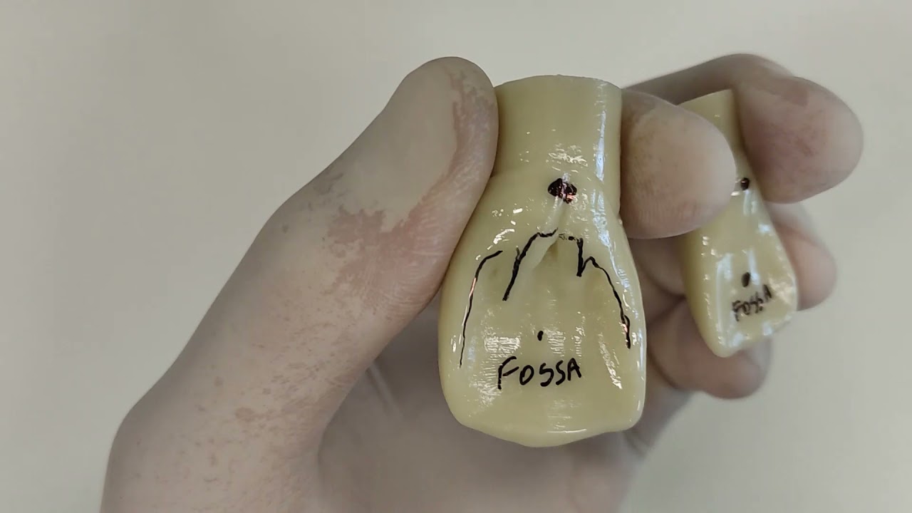 VÍDEO AULA PRÁTICA ANATOMIA DAS COROAS DENTAIS