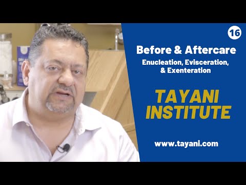 Before & After Care Enucleation, Evisceration, & Exenteration | Tayani Institute