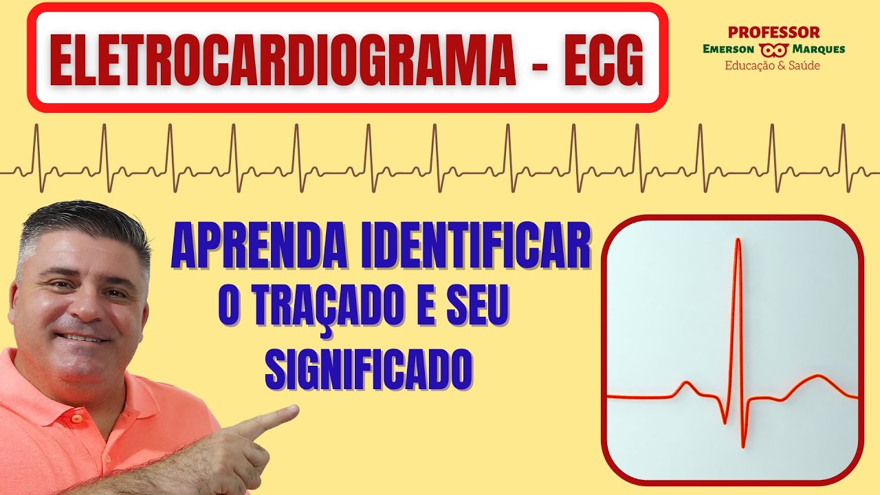 Aprenda identificar o traçado do ECG