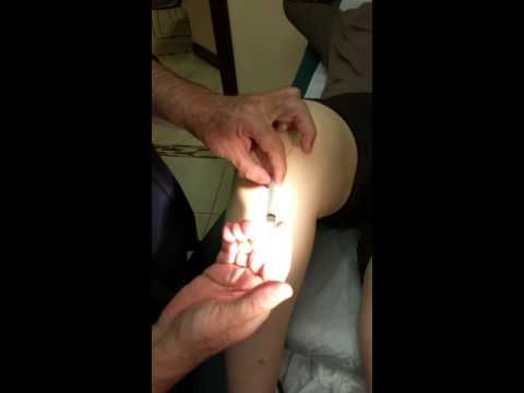 Operación pagado en la articulación de la rodilla Dolor de pierna y lomo de qué hacer