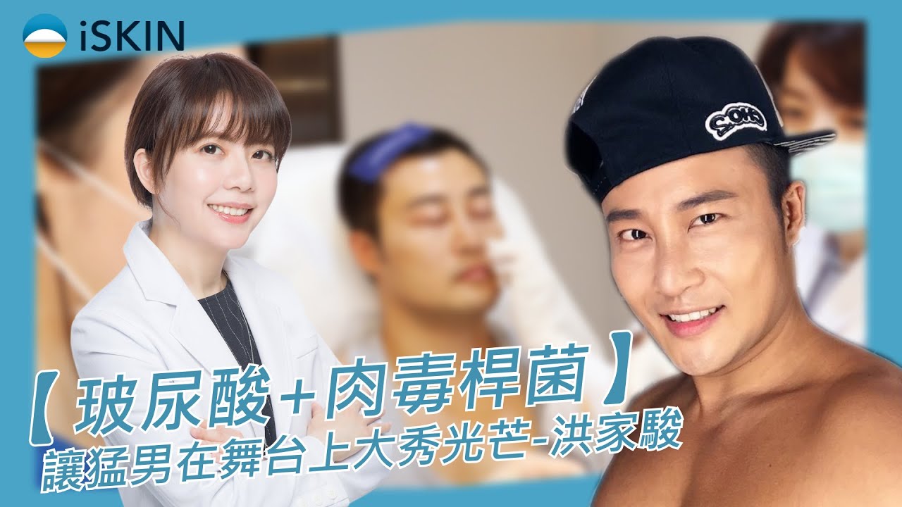 【玻尿酸+肉毒桿菌】 讓猛男在舞台上大秀光芒