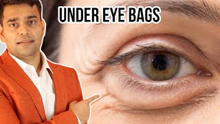 Under Eye Home Remedy | Remove Under Eye Bags Completely | Remove Dark Circle, Wrinkles, Puffy Eyes