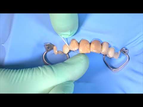 Rubber Dam Isolation In Anterior Region