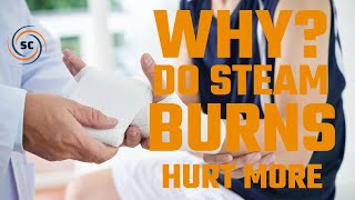 Why Do Steam Burns Hurt More - Steam Culture Flashback