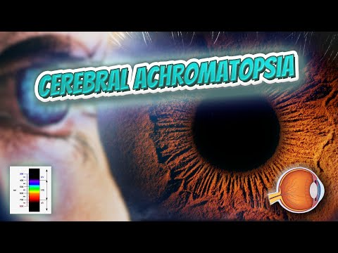 Cerebral achromatopsia - Your EYEBALLS - EYNTK 👁️💉😳💊🔊💯✅ Video