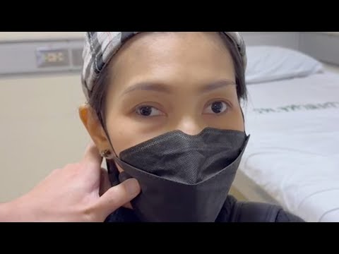 Ocular Neuromyotonia Before and After Treatment With Carbamazepine