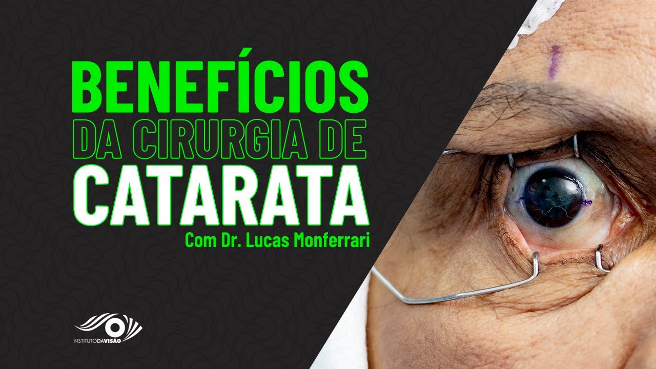 BENEFÍCIOS DA CIRURGIA DE CATARATA - Dr. Lucas Monferrari