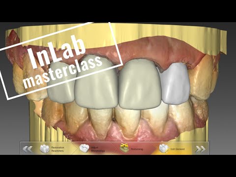 InLab Anterior Masterclass