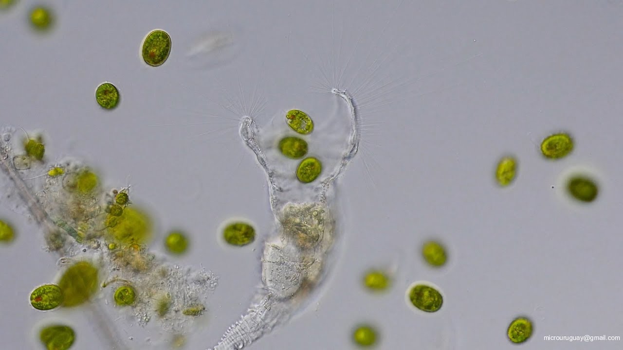 Rotifero Collotheca comiendo - Rotifer Collotheca eating