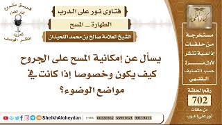 صورة 8651 -   إمكانية المسح على الجروح كيف يكون وخصوصا إذا كانت في مواضع الوضوء؟ - نور على الدرب