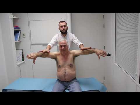 PRUEBA DE JOBE, VALORACIÓN DEL MÚSCULO SUPRAESPINOSO