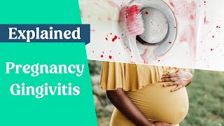 Pregnancy Gingivitis Explained