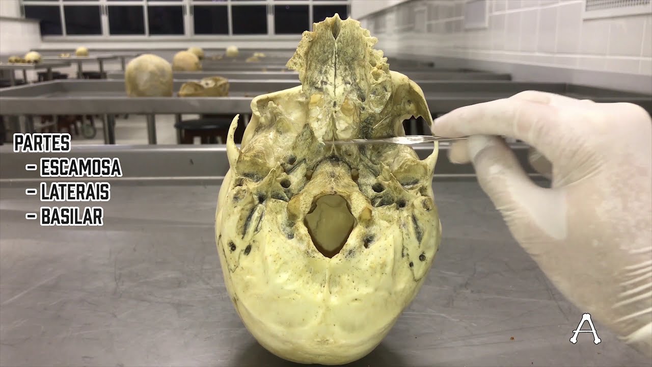 BASE DO CRÂNIO - Vista inferior - Anatomia