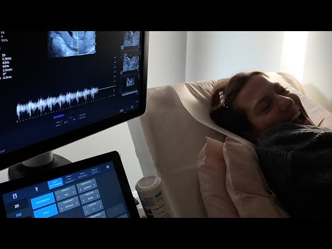 HAMİLEYİM! | Birinci Trimester Nasıl Geçti 😍