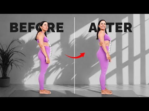 How I Fixed My Terrible Posture