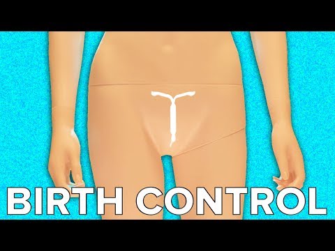 Your Body On IUD Birth Control