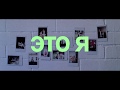 Teaser